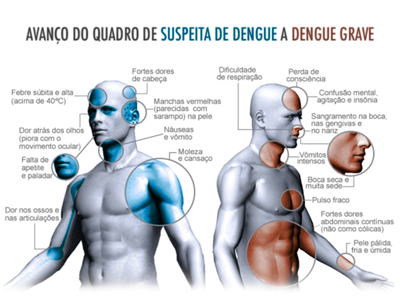 Avanço do quadro de suspeita de dengue a dengue grave.