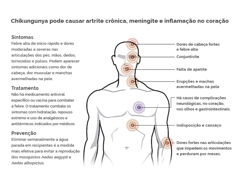 Sintomas da chikungunya